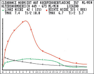 szintigraphisch erstellte Funktionskurve der Niere